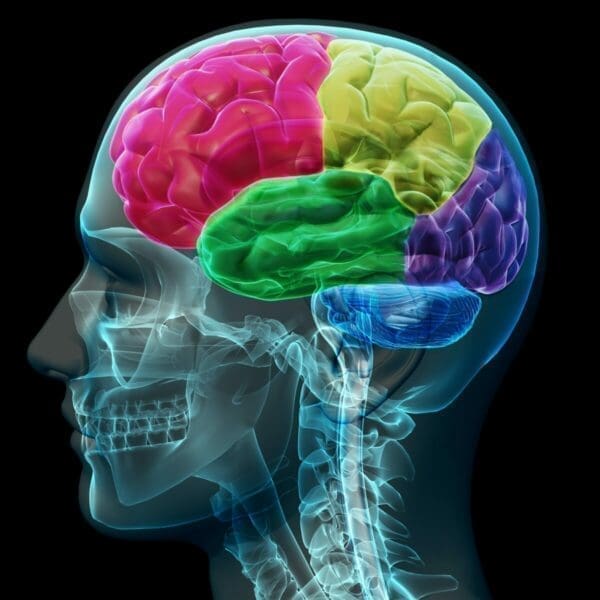 Xray showing colored sections of the brain